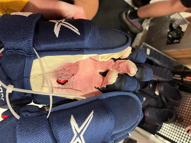 Patrick hornqvist gloves