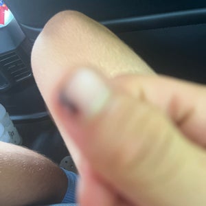 Finger nail (minor)